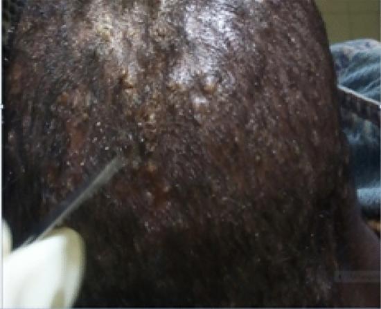 https://cdn.ncbi.nlm.nih.gov/pmc/blobs/c1a4/10224925/fbe3f8fd9a29/41598_2023_35837_Fig1_HTML.jpg