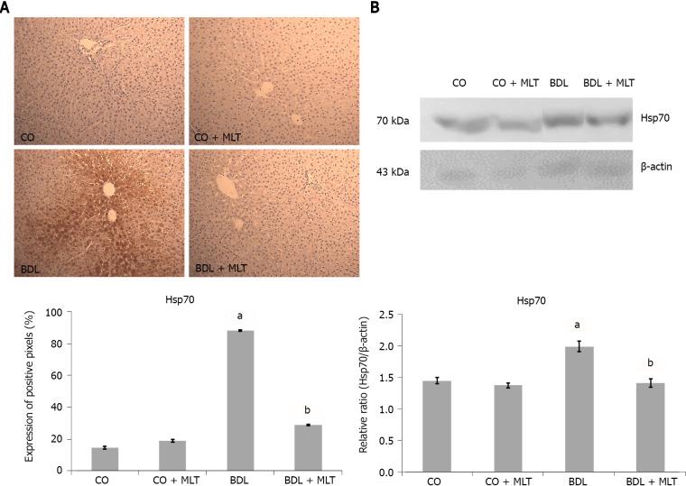 https://cdn.ncbi.nlm.nih.gov/pmc/blobs/c1aa/8771613/3fb16ff5714b/WJG-28-348-g006.jpg
