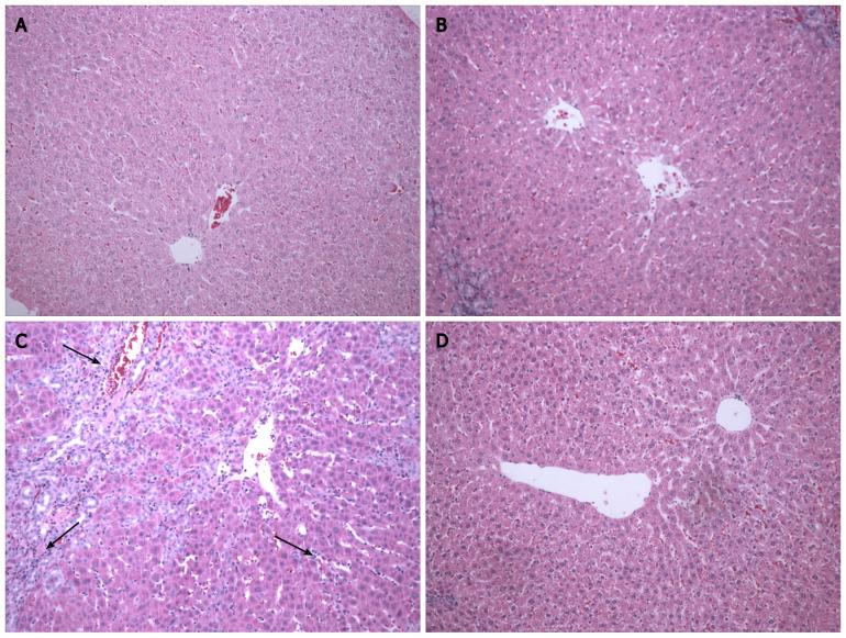 https://cdn.ncbi.nlm.nih.gov/pmc/blobs/c1aa/8771613/d932fdc169cf/WJG-28-348-g001.jpg