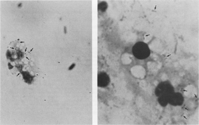 https://cdn.ncbi.nlm.nih.gov/pmc/blobs/c1ac/269108/6de443b98006/jcm00102-0215-a.jpg