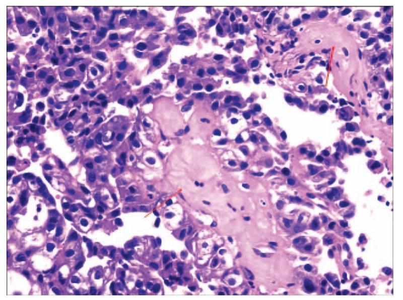 https://cdn.ncbi.nlm.nih.gov/pmc/blobs/c1ad/6133427/bec119486f64/medi-97-e11962-g007.jpg