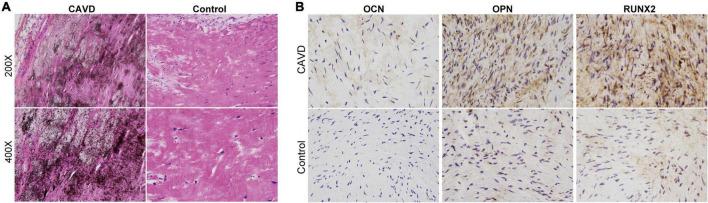 https://cdn.ncbi.nlm.nih.gov/pmc/blobs/c1b1/9606238/7337232e8c04/fcvm-09-944521-g001.jpg