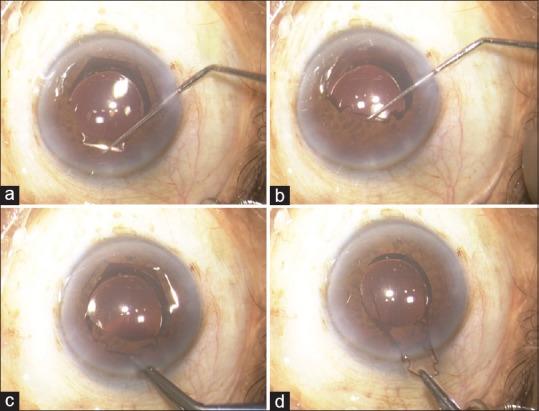 https://cdn.ncbi.nlm.nih.gov/pmc/blobs/c1b2/5742970/a16b99c7af07/IJO-65-1407-g004.jpg