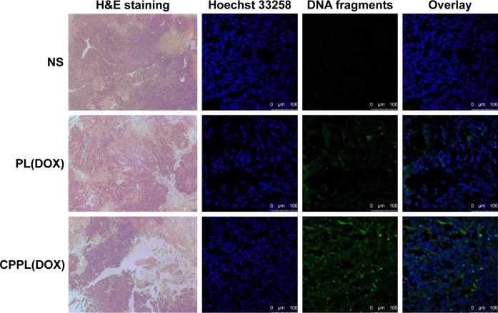 https://cdn.ncbi.nlm.nih.gov/pmc/blobs/c1c4/5661853/c4b40daa320c/dddt-11-3105Fig5.jpg