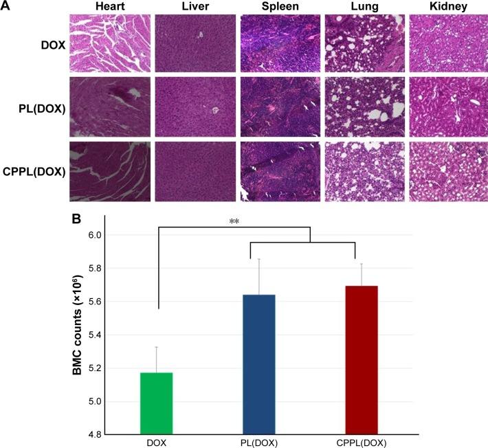 https://cdn.ncbi.nlm.nih.gov/pmc/blobs/c1c4/5661853/cd113e5803c1/dddt-11-3105Fig6.jpg