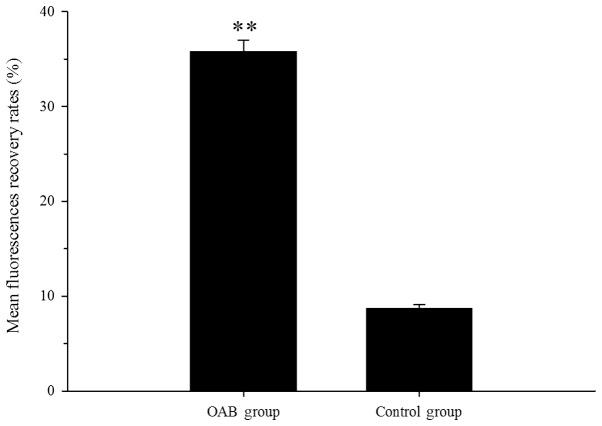 https://cdn.ncbi.nlm.nih.gov/pmc/blobs/c1c7/4887945/6c7ce831c6ab/etm-11-06-2139-g05.jpg