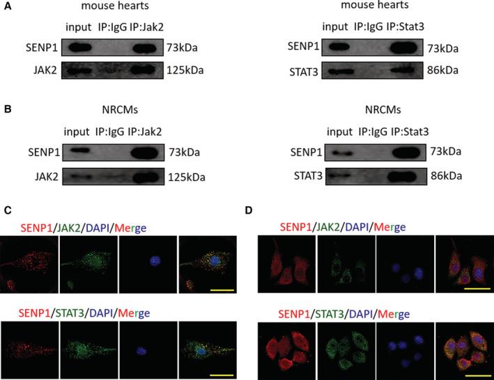 https://cdn.ncbi.nlm.nih.gov/pmc/blobs/c1cb/9750077/8de1b8333acc/JAH3-11-e027004-g003.jpg