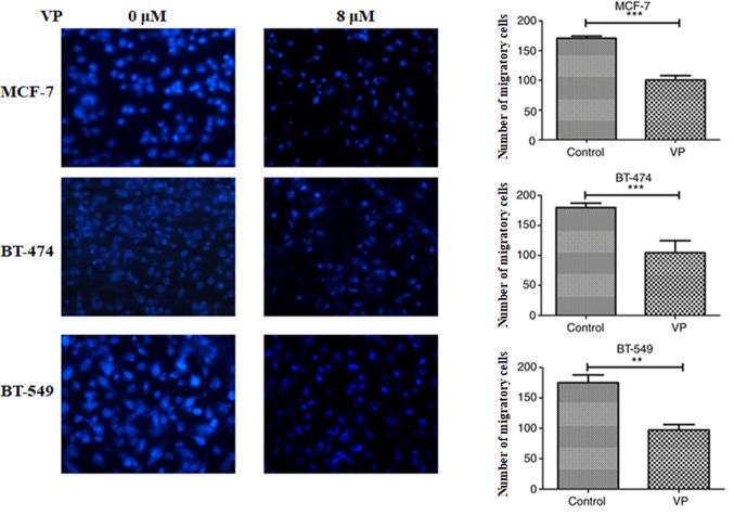https://cdn.ncbi.nlm.nih.gov/pmc/blobs/c1cf/7533488/c977a33f8e0d/MMR-22-05-3955-g02.jpg