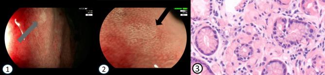 https://cdn.ncbi.nlm.nih.gov/pmc/blobs/c1d3/11462652/6c9c306e13c6/13053_2024_293_Fig1_HTML.jpg