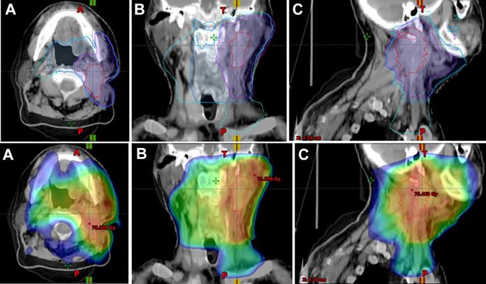 https://cdn.ncbi.nlm.nih.gov/pmc/blobs/c1d3/7268107/0bcb4f146502/10.1177_1533033820905826-fig1.jpg