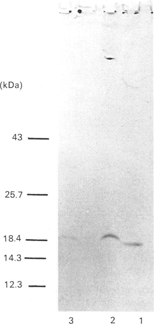 https://cdn.ncbi.nlm.nih.gov/pmc/blobs/c1d9/1135507/8b3ba8b65f34/biochemj00217-0250-a.jpg