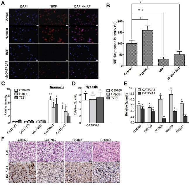 https://cdn.ncbi.nlm.nih.gov/pmc/blobs/c1df/5593610/ce24ab2ff3a4/oncotarget-08-56880-g005.jpg