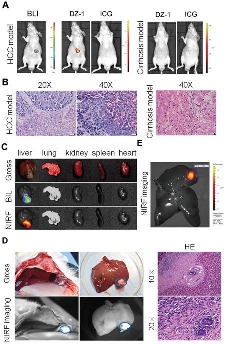 https://cdn.ncbi.nlm.nih.gov/pmc/blobs/c1df/5593610/e6dd88bd4480/oncotarget-08-56880-g003.jpg