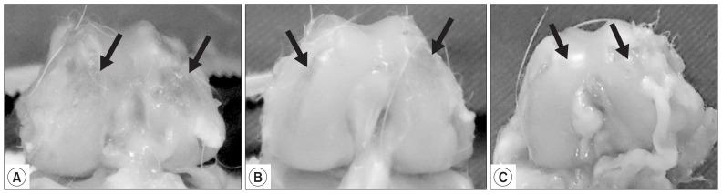 https://cdn.ncbi.nlm.nih.gov/pmc/blobs/c1eb/6425894/57be4a6ba7b9/ksrr-31-044f4.jpg