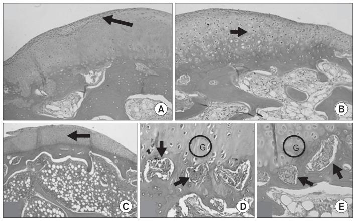 https://cdn.ncbi.nlm.nih.gov/pmc/blobs/c1eb/6425894/c40000e49cfe/ksrr-31-044f7.jpg