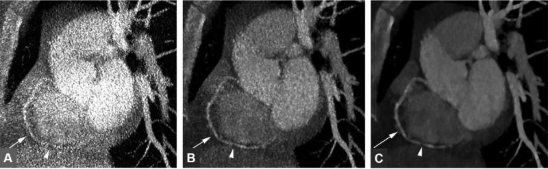 https://cdn.ncbi.nlm.nih.gov/pmc/blobs/c1ef/5481820/49e6dd631975/bc-2017-00194c_0004.jpg