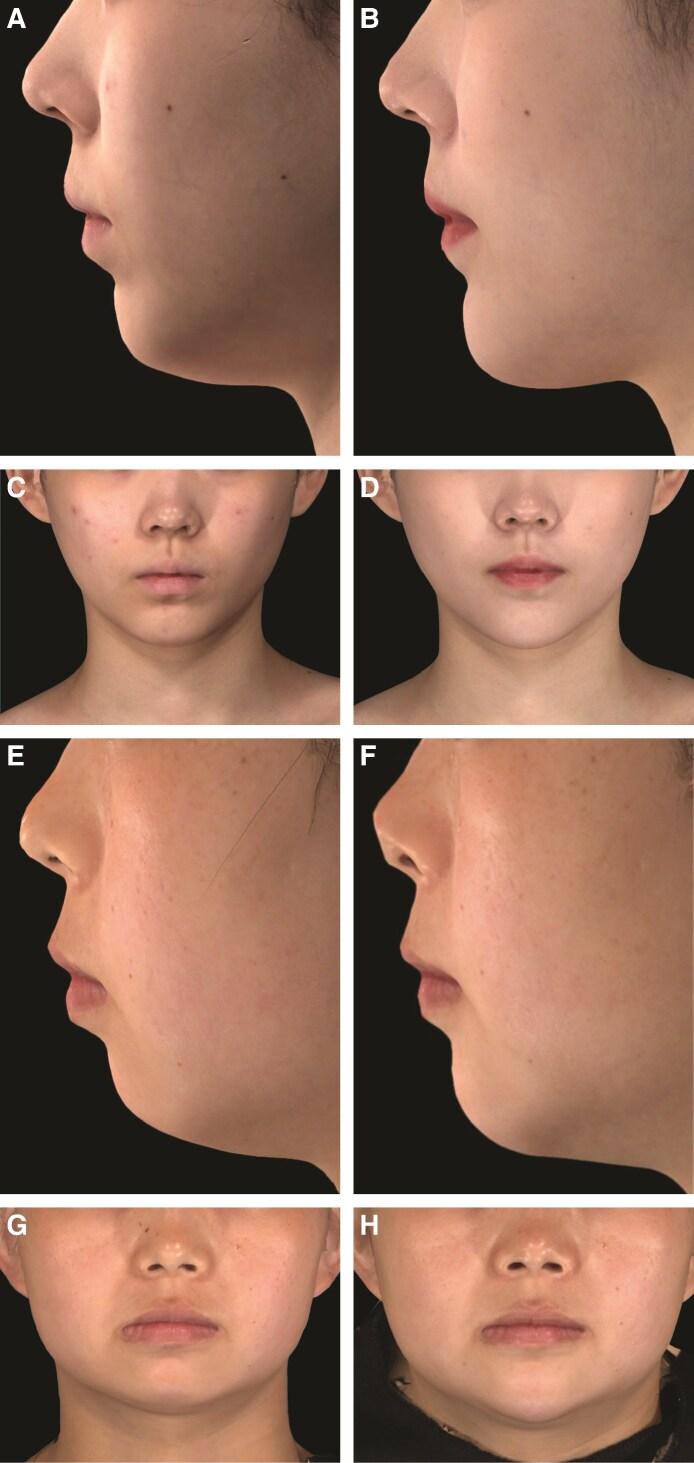https://cdn.ncbi.nlm.nih.gov/pmc/blobs/c1f3/12168443/1458ce087ac0/sjaf033f7a.jpg