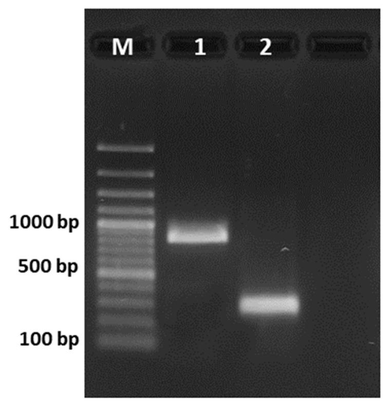 https://cdn.ncbi.nlm.nih.gov/pmc/blobs/c1f5/8705981/7414ac229ffa/toxins-13-00892-g002.jpg