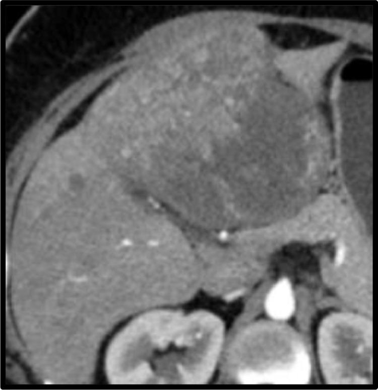 https://cdn.ncbi.nlm.nih.gov/pmc/blobs/c207/7502789/ed2e1d65e54b/gr2.jpg