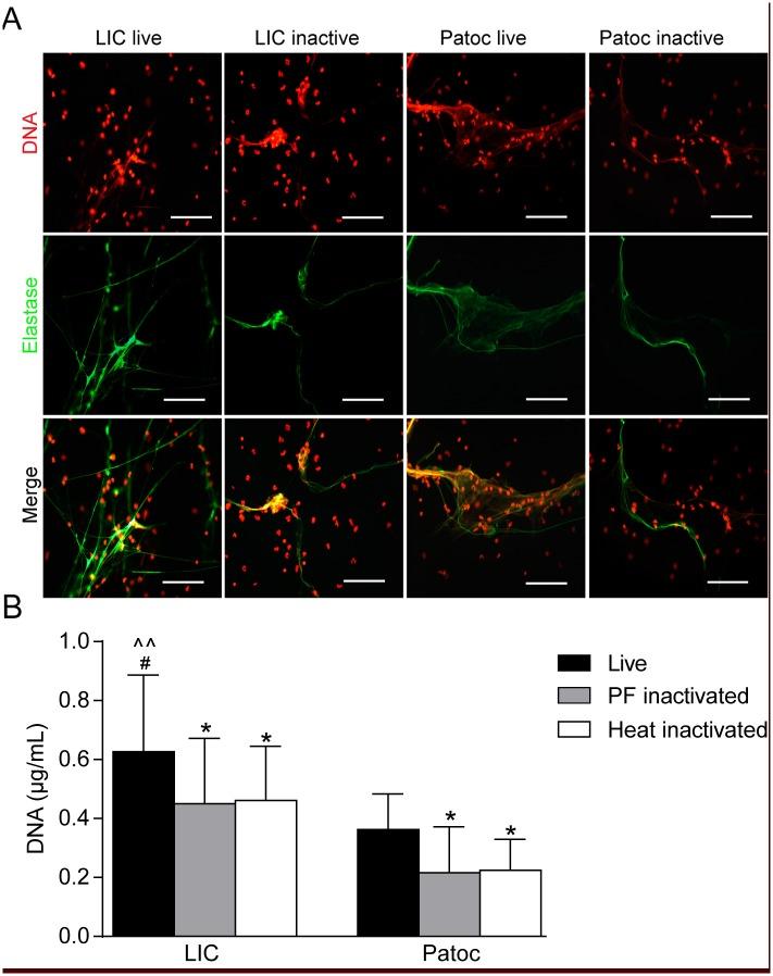 https://cdn.ncbi.nlm.nih.gov/pmc/blobs/c20b/4498591/f2deae8b00f0/pntd.0003927.g002.jpg