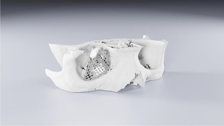 https://cdn.ncbi.nlm.nih.gov/pmc/blobs/c218/10235146/272e98e852d6/10006_2022_1065_Fig1_HTML.jpg