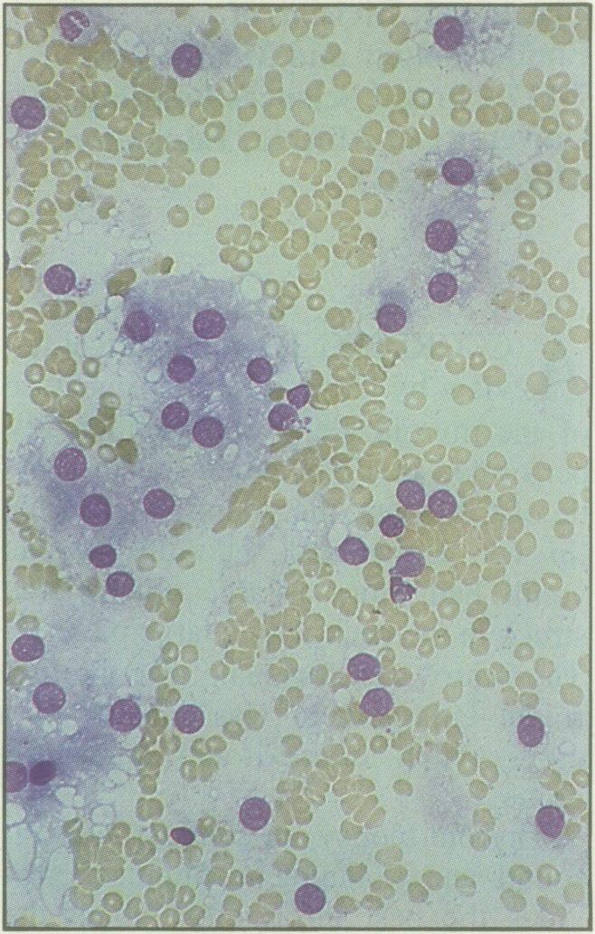 https://cdn.ncbi.nlm.nih.gov/pmc/blobs/c21d/2218653/57fc89c09e77/canfamphys00187-0176-b.jpg