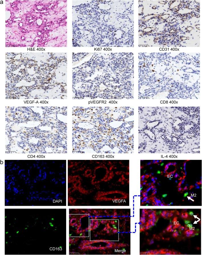 https://cdn.ncbi.nlm.nih.gov/pmc/blobs/c21e/7216554/4fe19af77ad1/13045_2020_886_Fig3_HTML.jpg