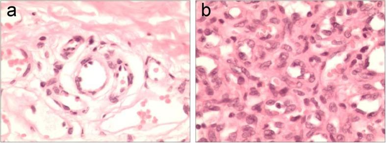 https://cdn.ncbi.nlm.nih.gov/pmc/blobs/c21e/7216554/f8b8043734a8/13045_2020_886_Fig2_HTML.jpg