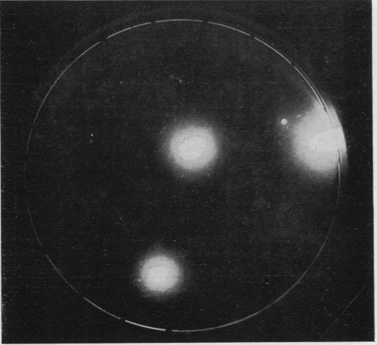 https://cdn.ncbi.nlm.nih.gov/pmc/blobs/c230/1023358/5d9c6c772c92/jclinpath00014-0075-b.jpg