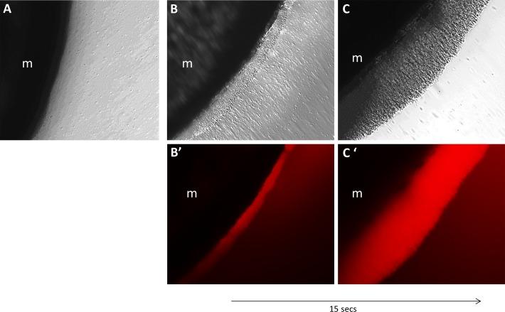 https://cdn.ncbi.nlm.nih.gov/pmc/blobs/c232/4586943/a3a45a8030ec/10.1177_2325967114566185-fig3.jpg