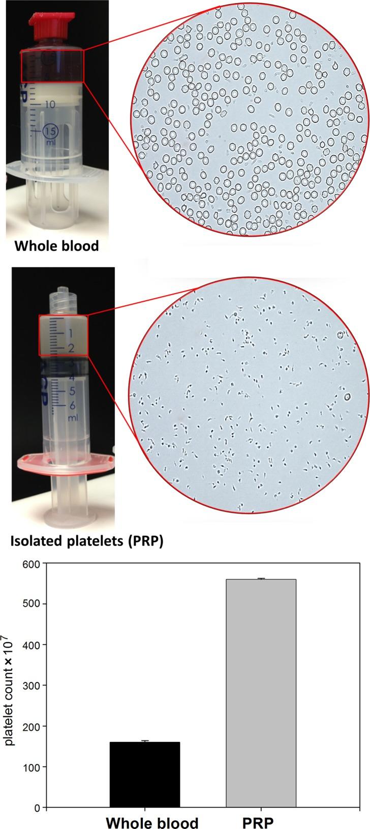 https://cdn.ncbi.nlm.nih.gov/pmc/blobs/c232/4586943/cdc308a3a0ca/10.1177_2325967114566185-fig1.jpg