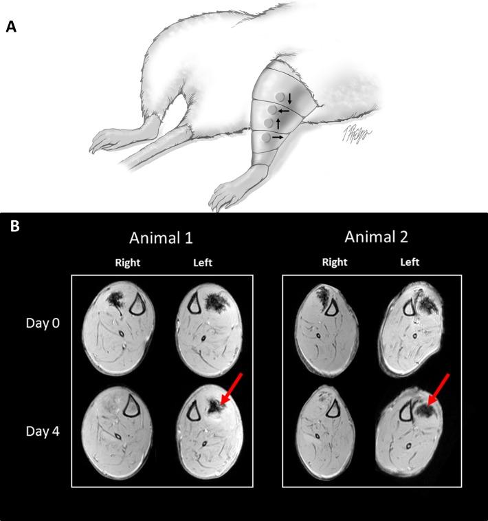 https://cdn.ncbi.nlm.nih.gov/pmc/blobs/c232/4586943/dbf1d42b0d82/10.1177_2325967114566185-fig4.jpg