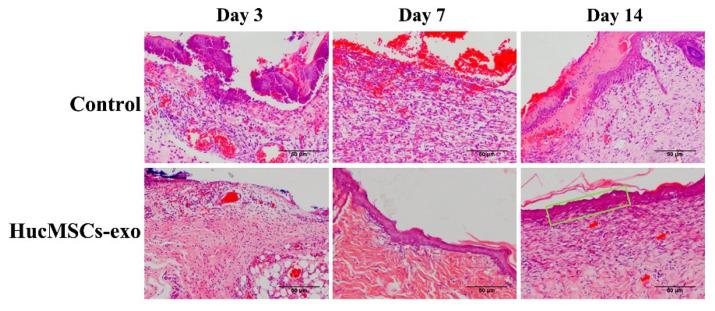 https://cdn.ncbi.nlm.nih.gov/pmc/blobs/c232/9498995/e4d4e2733033/ijms-23-10421-g004.jpg
