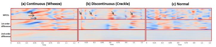 https://cdn.ncbi.nlm.nih.gov/pmc/blobs/c23d/8074359/0cb2d236a101/diagnostics-11-00732-g003.jpg