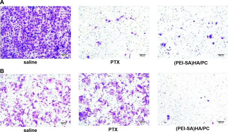 https://cdn.ncbi.nlm.nih.gov/pmc/blobs/c246/6898996/cdc77db07ecb/IJN-14-9453-g0005.jpg