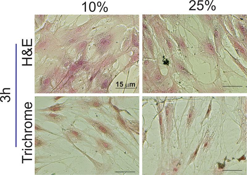 https://cdn.ncbi.nlm.nih.gov/pmc/blobs/c247/5054995/42f623f5b7bf/gox-4-e0864-g009.jpg