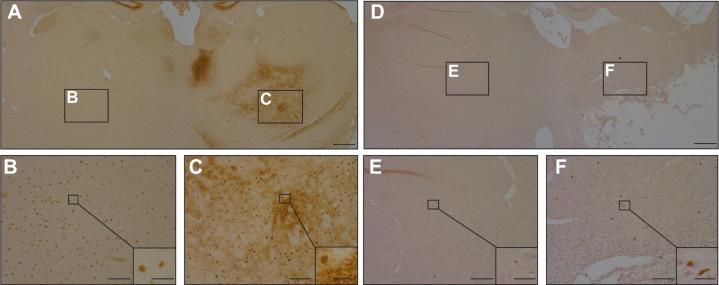 https://cdn.ncbi.nlm.nih.gov/pmc/blobs/c250/4298295/b8efc9d493a0/ndt-11-153Fig6.jpg