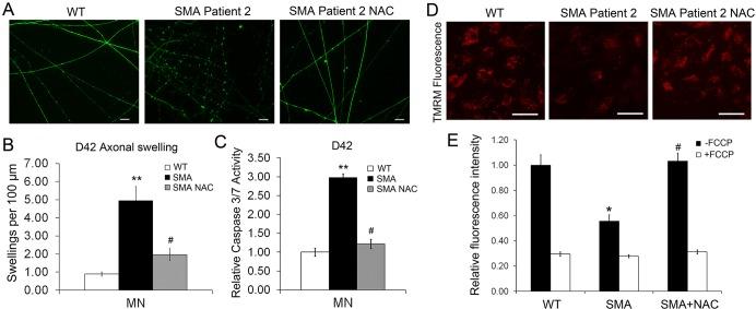 https://cdn.ncbi.nlm.nih.gov/pmc/blobs/c25b/4728333/2f23ed1cf212/dmm-9-021766-g7.jpg