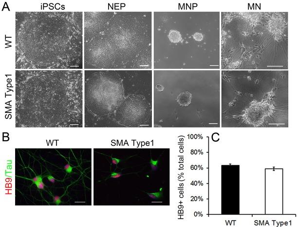 https://cdn.ncbi.nlm.nih.gov/pmc/blobs/c25b/4728333/a2c23f981b5f/dmm-9-021766-g2.jpg