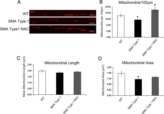 https://cdn.ncbi.nlm.nih.gov/pmc/blobs/c25b/4728333/ea8c9275dba2/dmm-9-021766-g4.jpg