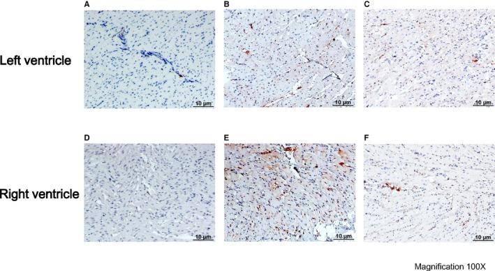 https://cdn.ncbi.nlm.nih.gov/pmc/blobs/c265/5523999/f0c74515b4a8/JAH3-6-e004479-g006.jpg