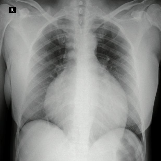 https://cdn.ncbi.nlm.nih.gov/pmc/blobs/c279/8891785/aa08df87c767/WJCC-10-1869-g002.jpg