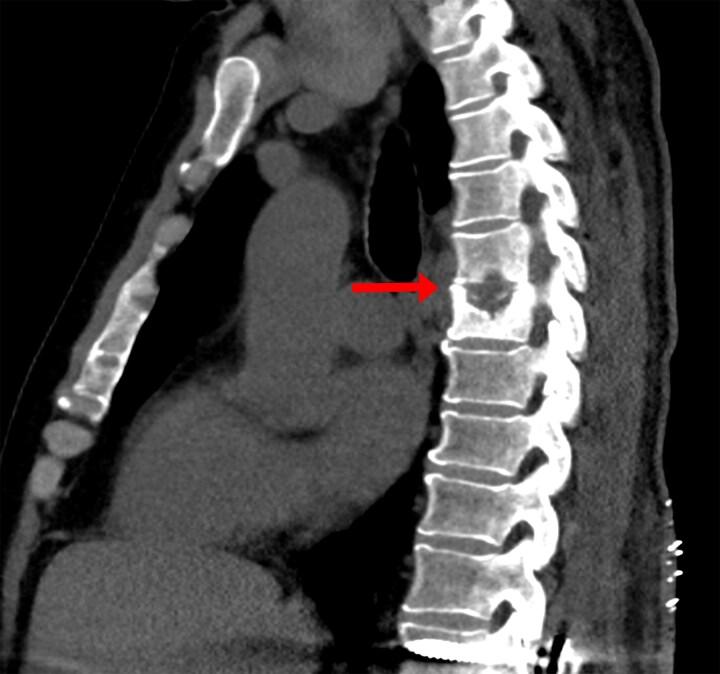 https://cdn.ncbi.nlm.nih.gov/pmc/blobs/c27a/12282389/8e50bef1c03a/ofaf398f1.jpg