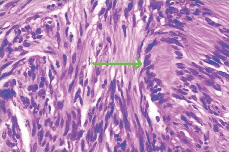 https://cdn.ncbi.nlm.nih.gov/pmc/blobs/c27c/3778803/7af611c02f56/IJD-58-407e-g004.jpg