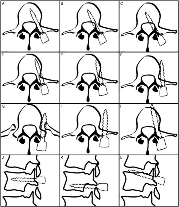 https://cdn.ncbi.nlm.nih.gov/pmc/blobs/c27d/10783280/1f84acaef86e/ms9-86-199-g005.jpg