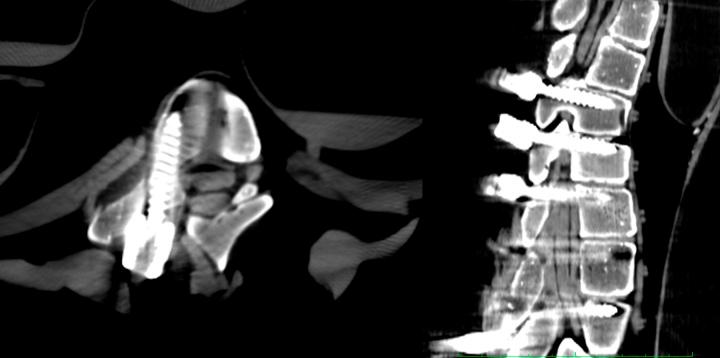 https://cdn.ncbi.nlm.nih.gov/pmc/blobs/c27d/10783280/41e12e6c836d/ms9-86-199-g003.jpg