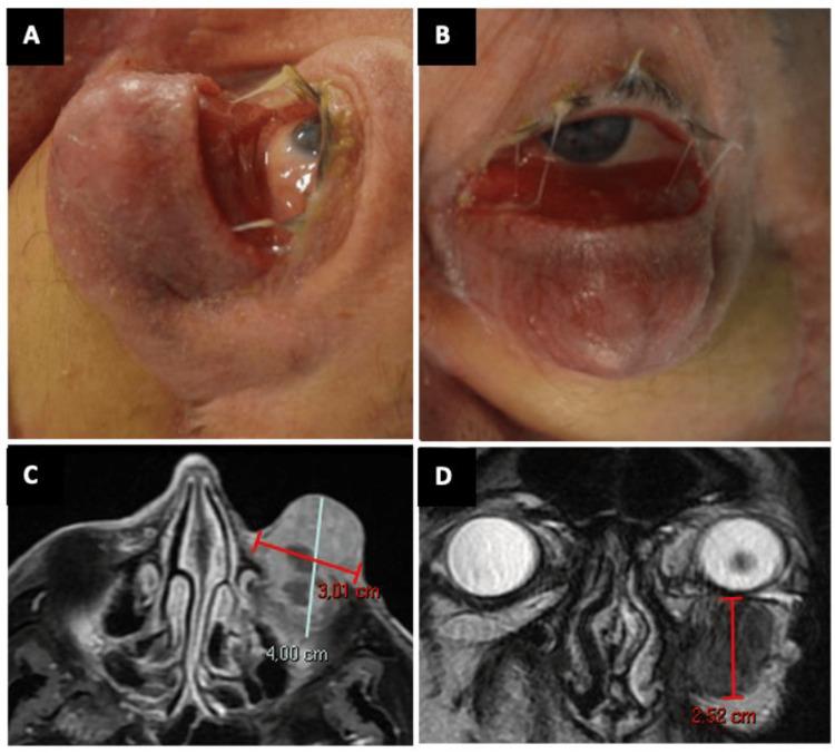 https://cdn.ncbi.nlm.nih.gov/pmc/blobs/c27e/11181248/d0f94e05e4af/cureus-0016-00000060541-i02.jpg
