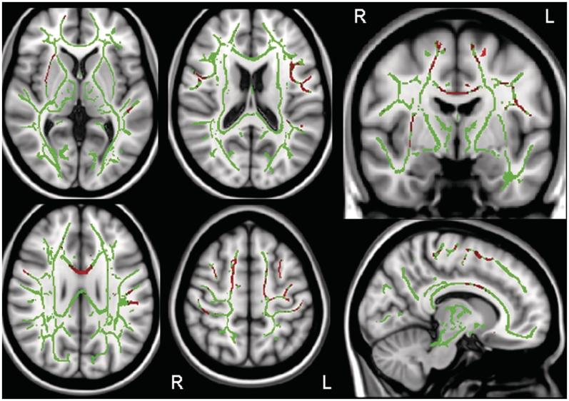https://cdn.ncbi.nlm.nih.gov/pmc/blobs/c287/3338923/3fb894980004/aws032f2.jpg