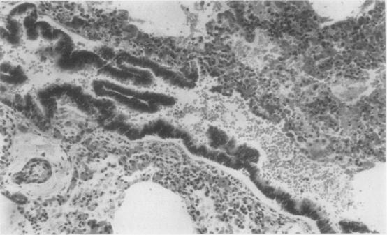 https://cdn.ncbi.nlm.nih.gov/pmc/blobs/c28a/480602/2b96034478e9/jclinpath00076-0030-a.jpg