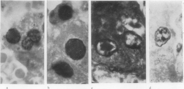 https://cdn.ncbi.nlm.nih.gov/pmc/blobs/c28a/480602/3eb51d0aa08c/jclinpath00076-0034-a.jpg